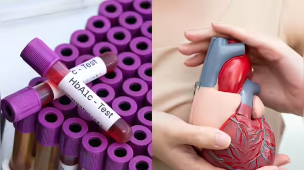 High HbA1c Level in Non-Diabetics