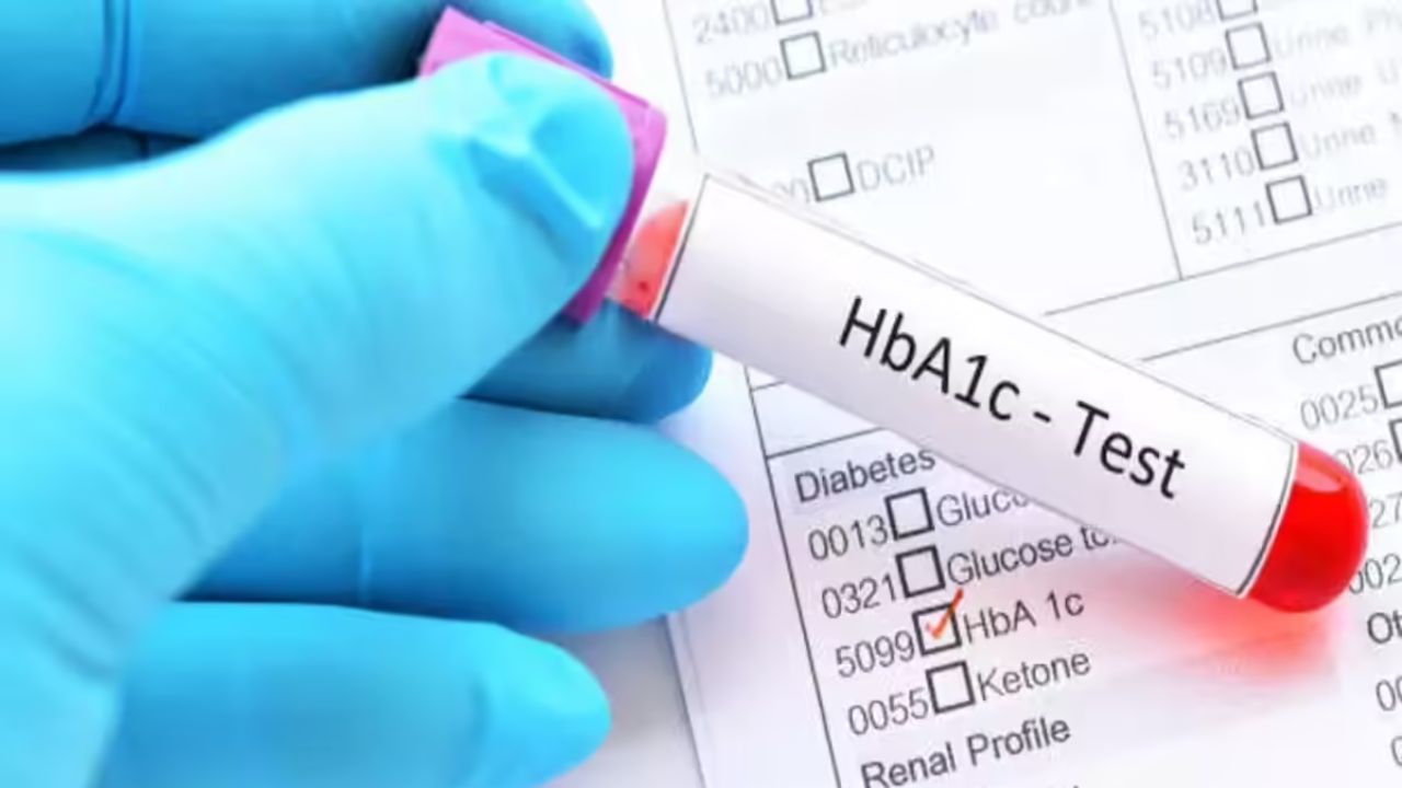 Diabetes HbA1c