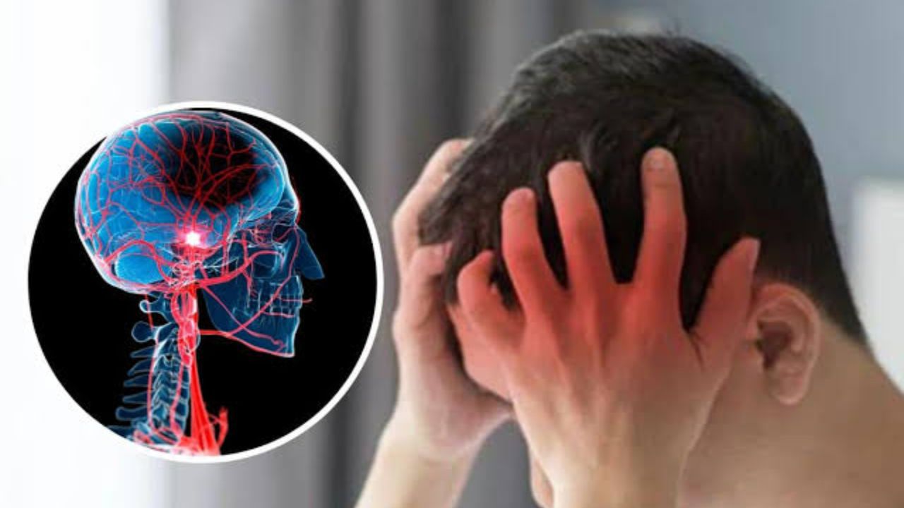 brain stroke in youth